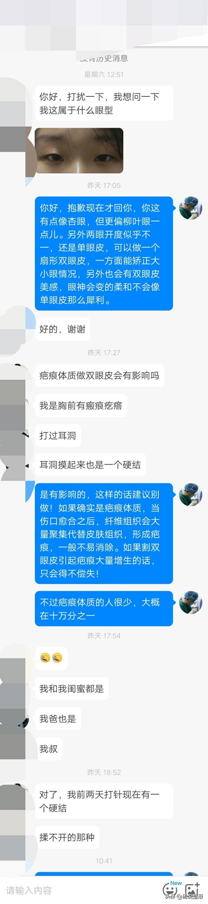 割双眼皮一定好看吗,割双眼皮真的好看吗