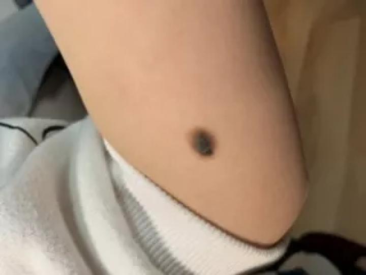 哪些部位长痣预示一生劳碌,痣的位置预示着什么