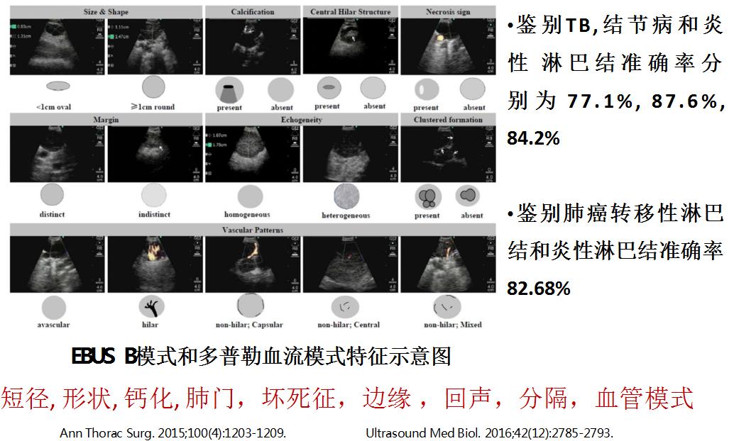 小细胞肺癌的气管镜介入治疗,导航支气管镜在肺癌诊断中的应用