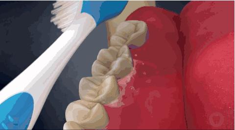 草莓籽在嘴里发了芽？刷牙少了这一步，你真的只是刷了个寂寞