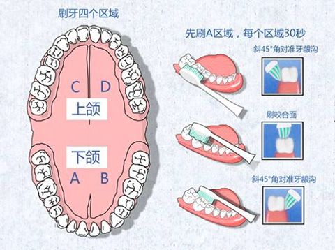 电动牙刷是智商税还是必需品,声波牙刷是智商税吗