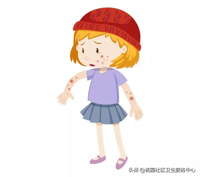 关于水痘高发期的注意事项,水痘的坑怎么消