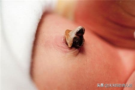 新生儿脐带一个月不掉感觉有点长,新生儿脐带你必须知道的常识