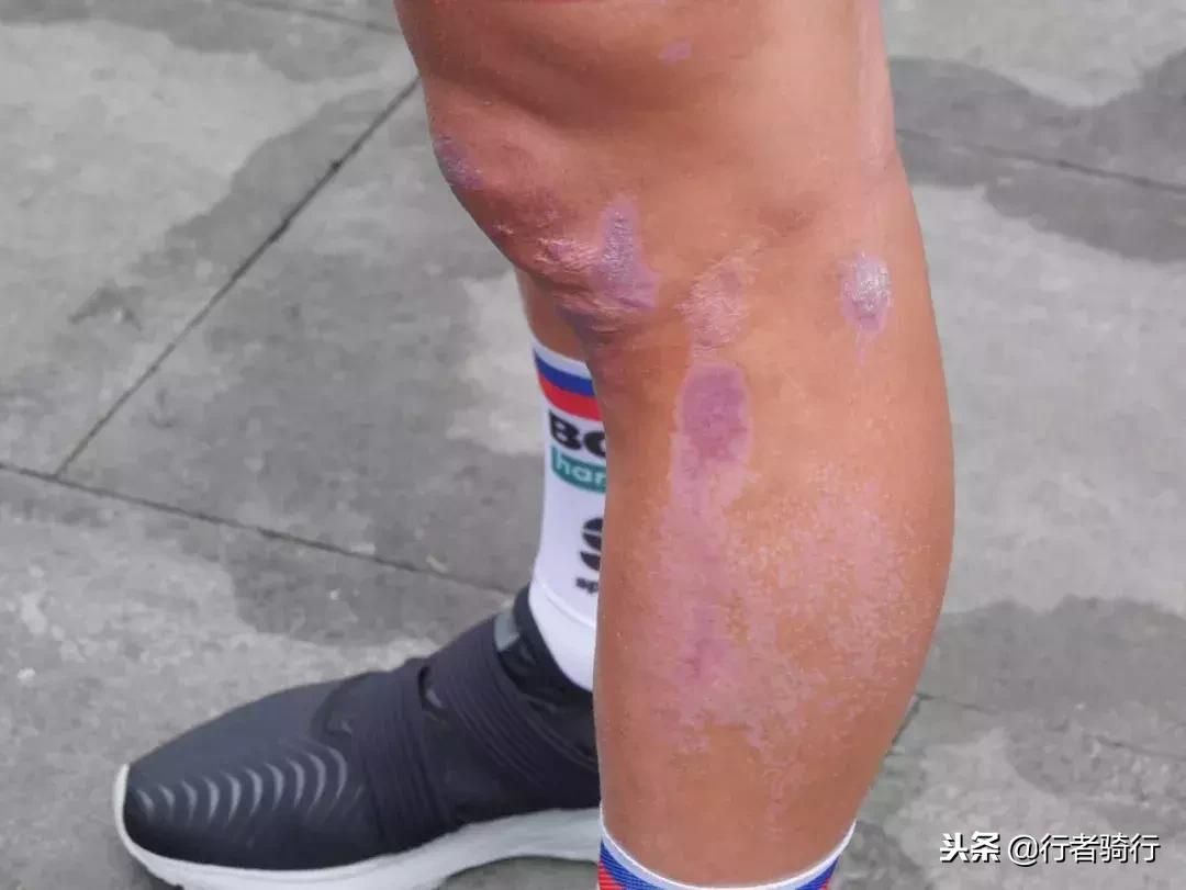 萨甘有没有拿过环法单站冠军,环法11赛段萨甘撞范阿尔特视频