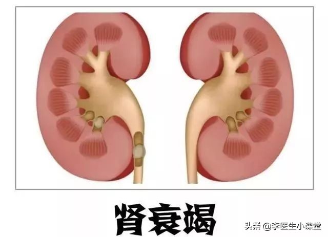 老年人补钙对骨关节有帮助吗,老年骨关节炎是否要补充钙d