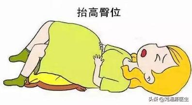 「免疫相关不良妊娠答疑解惑53」——宫颈机能不全