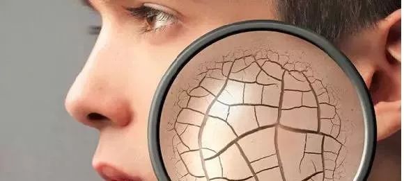 毛孔粗大原因及如何改善,突然毛孔粗大是什么原因