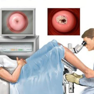 妇科炎症对号入座,你一看就明白