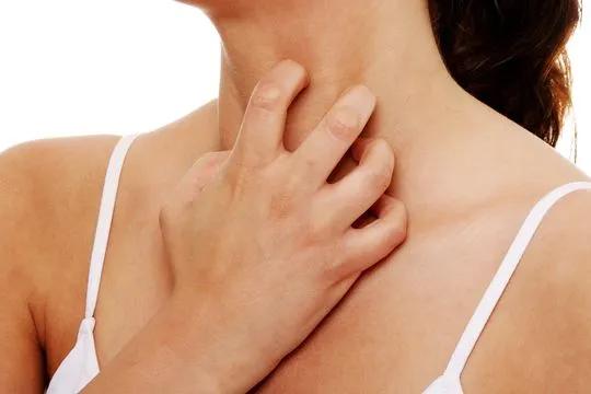 湿疹性皮炎最简单的自愈方法,全身都痒皮炎湿疹最好的治疗方法