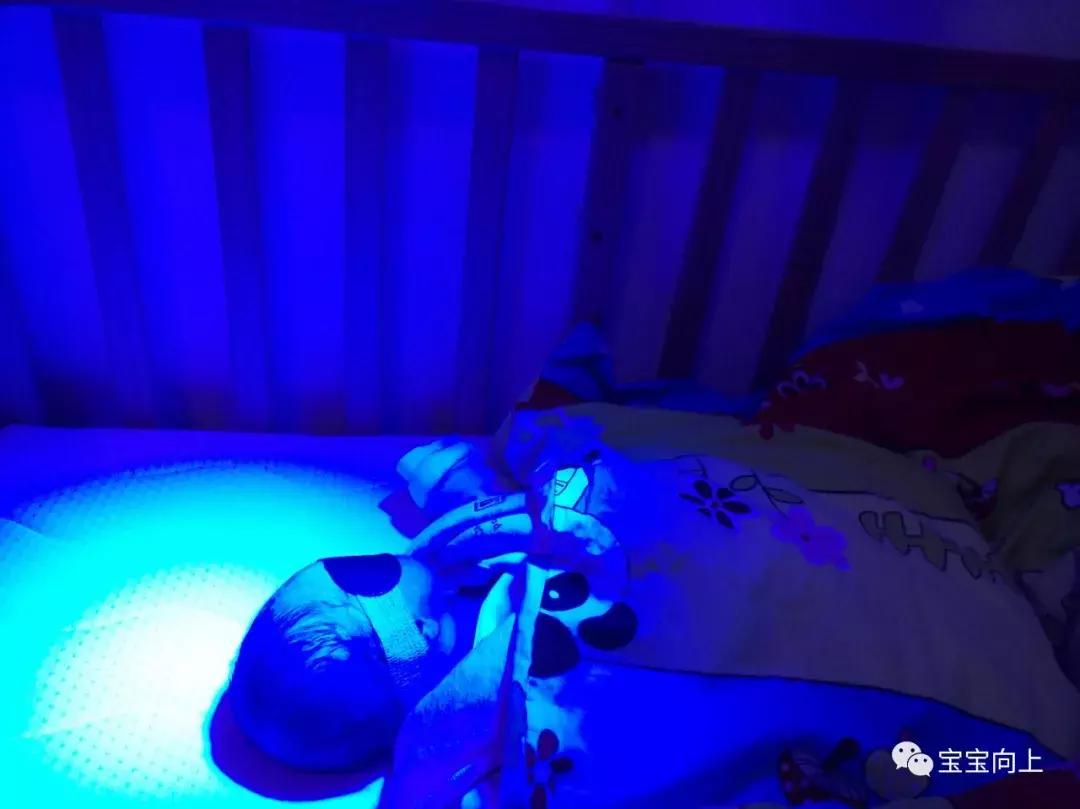 哪些偏方可以去黄疸,治疗黄疸一定要停母乳吗