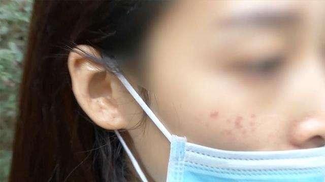 女子被黑心医生整容毁容,做美容差点毁容女子哭诉被坑经历