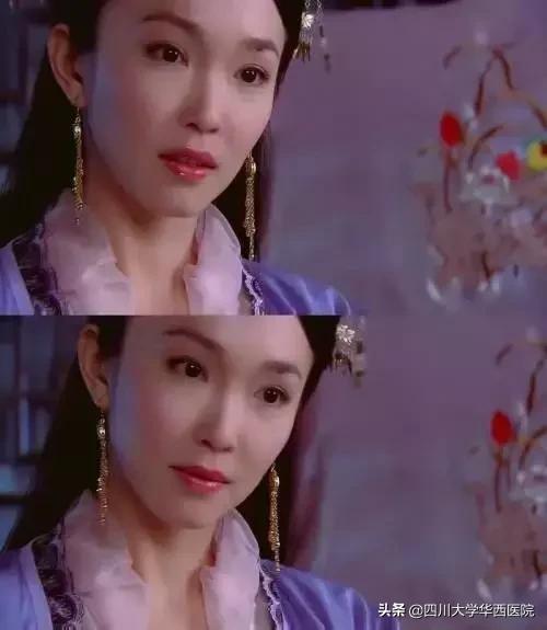 鼻子太翘怎么整形,鼻子太尖整形修复最佳方法