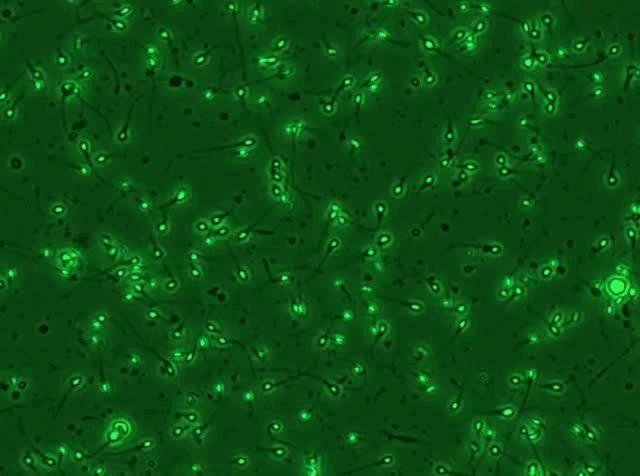 精子是如何产生的百科,精子是不是每天都能生成