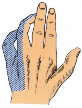 鎵嬮儴涓灑绁炵粡鍙楁崯浼氬紩璧锋墜楹诲悧,鎵嬮儴绁炵粡鍙楁崯鎵嬮夯鎬庝箞鍥炰簨