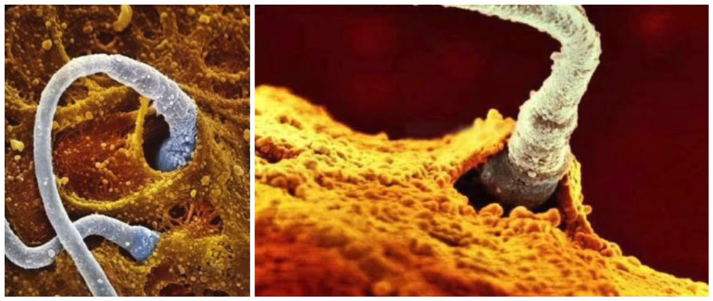 摄影师记录妻子怀孕纪录片,胎儿高清摄影