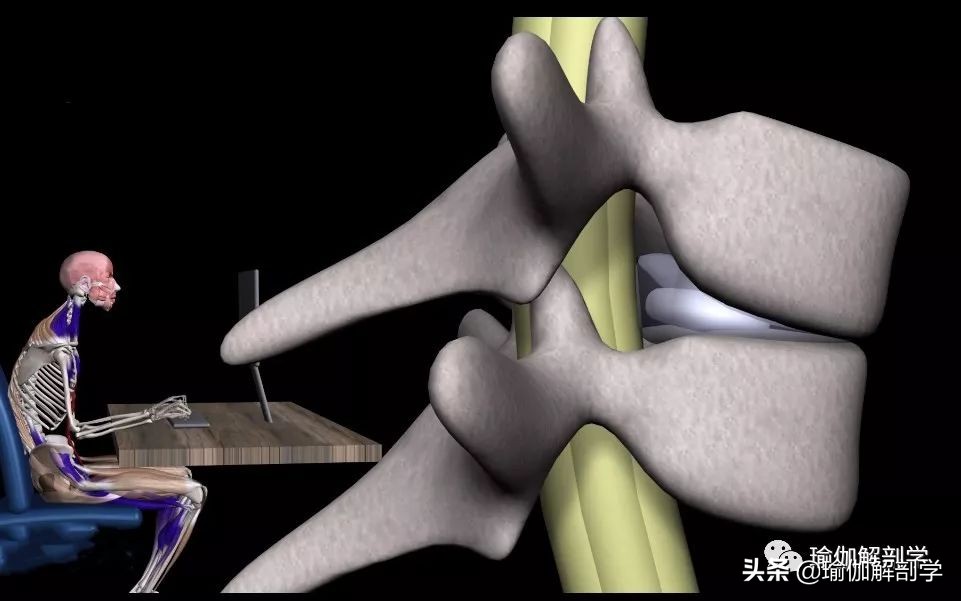 腰椎间盘突出适合练瑜伽哪些动作,腰椎间盘突出做什么瑜伽可以恢复