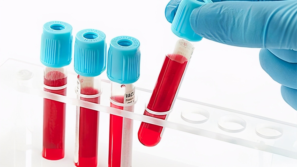 体检发现红细胞增多是怎么回事,体检发现红细胞超过正常值怎么办