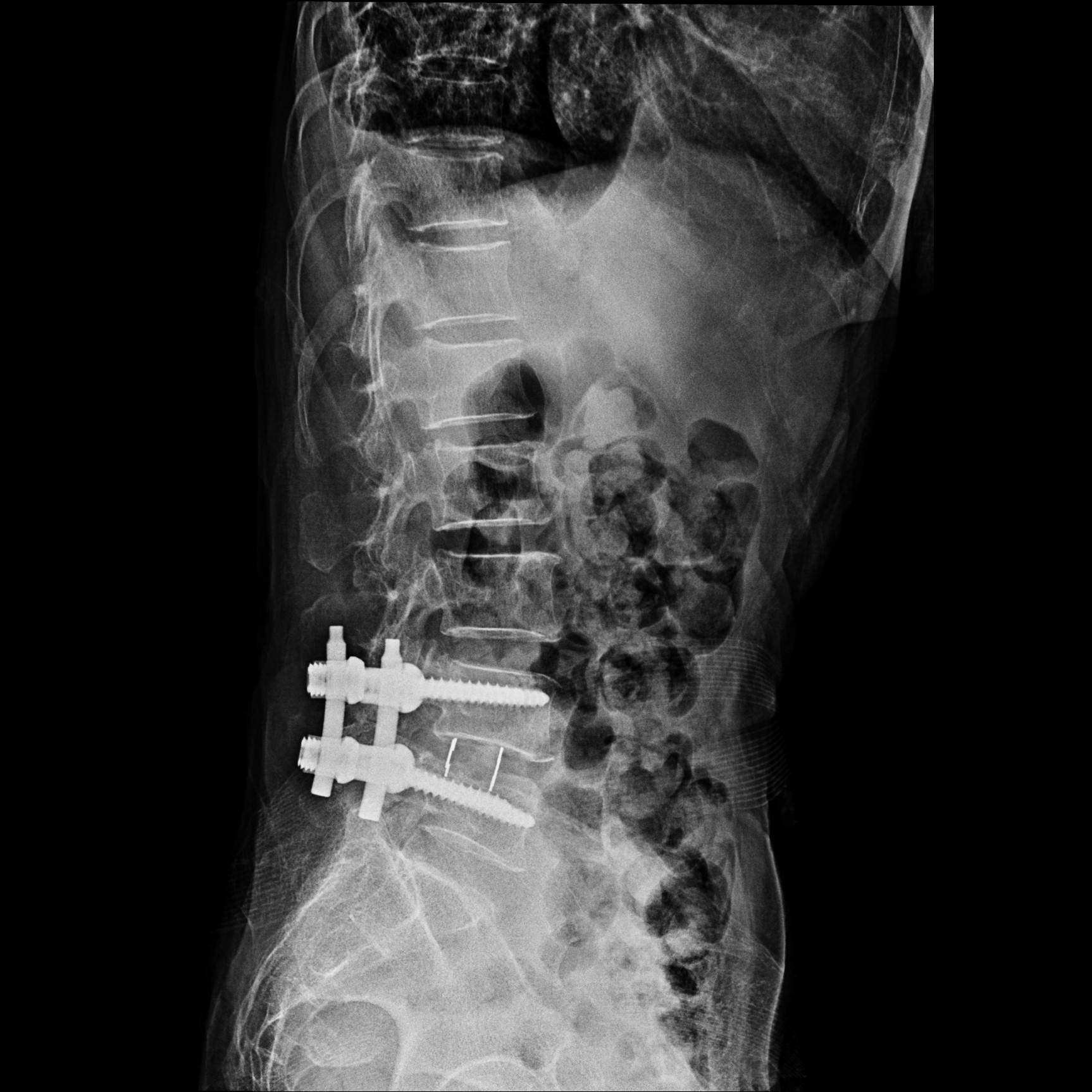 腰痛原因多，何医生带你一起来聊聊