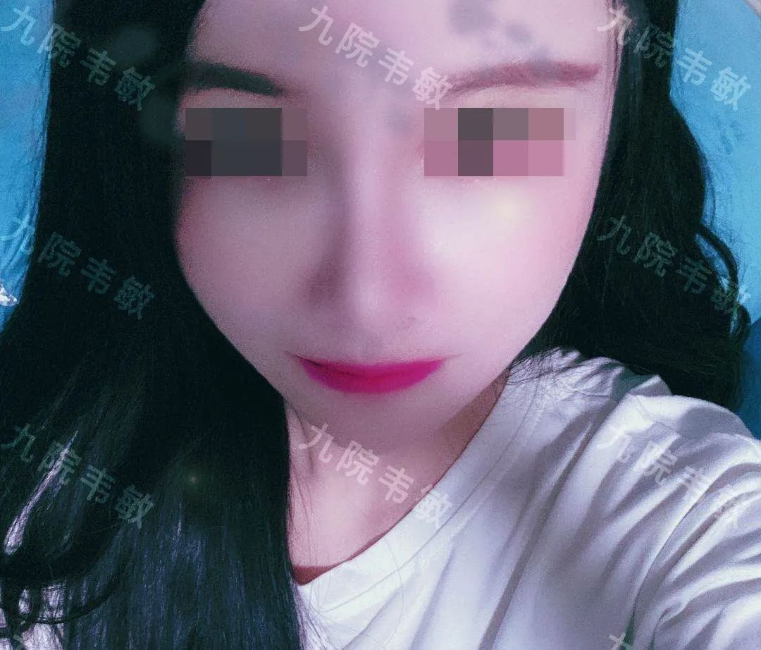 我终于摆脱了扁塌鼻这个颜值“拖油瓶”
