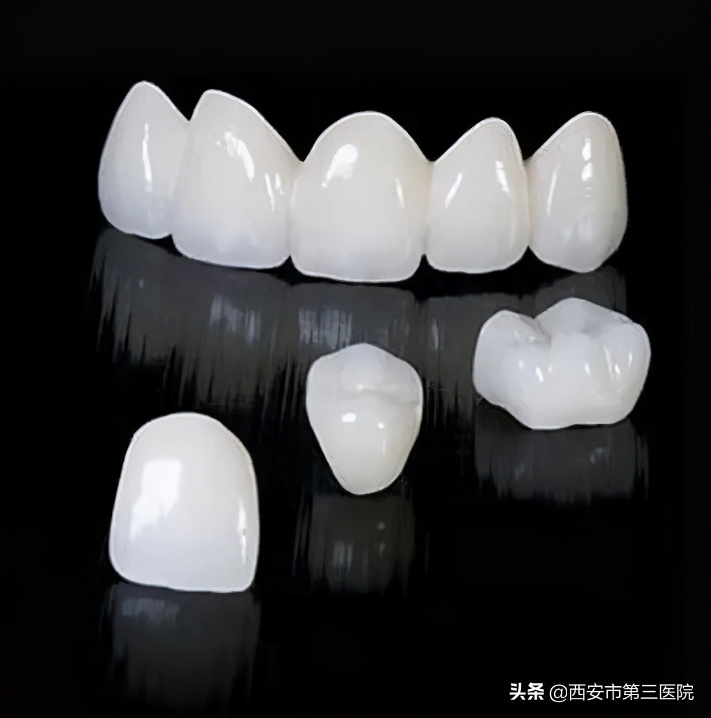 常见牙齿美白方式大盘点,牙齿美白性价比最高的方法