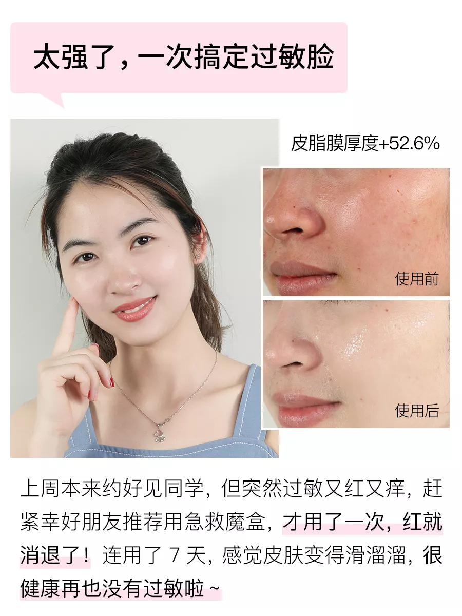 急救面膜3分钟见效,急救补水面膜爆款面膜