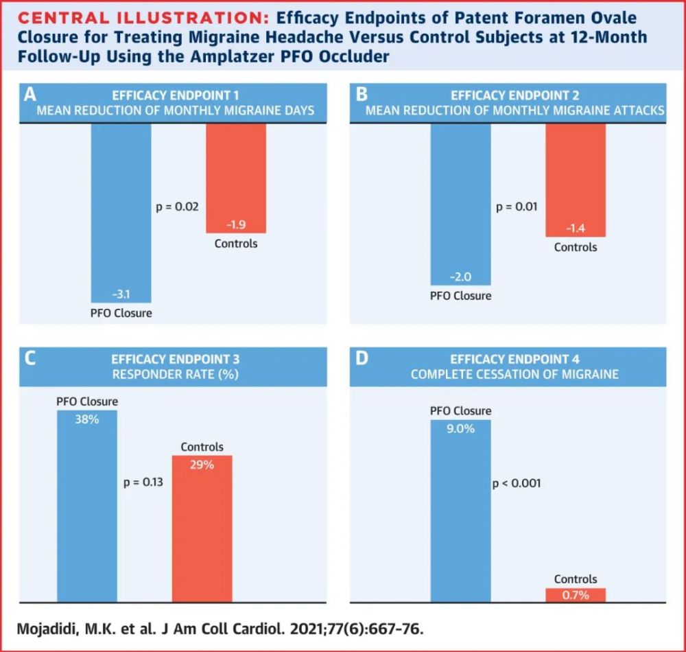 偏头痛有什么偏方能治好,偏头痛的人究竟要怎么治