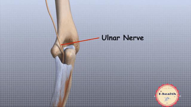 【运动损伤Respond】第一期，俯卧撑与肘关节疼痛。