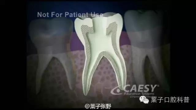 牙龈反复鼓包流脓是牙齿坏了吗,一上火牙龈就鼓包