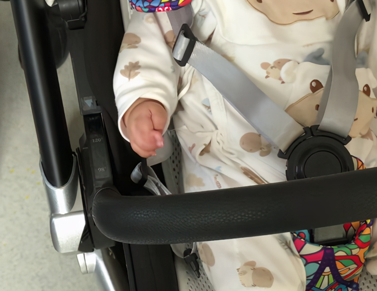 并指手术不植皮新技术,儿童并指免植皮案例