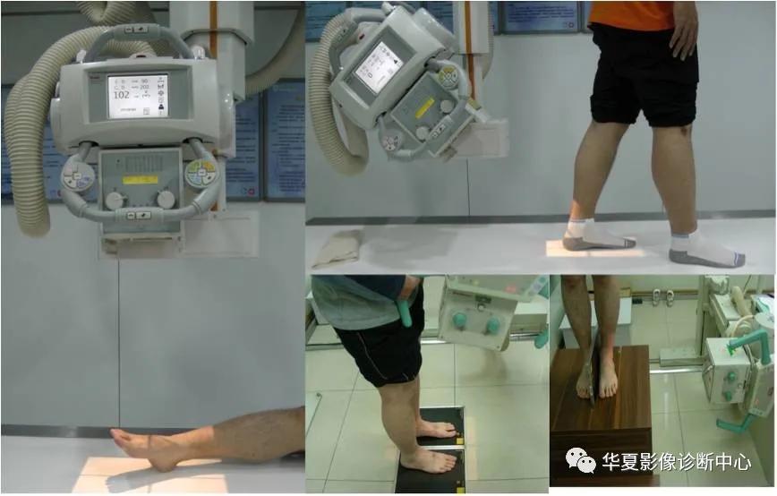 跗骨联合,跗骨与跖骨解剖图