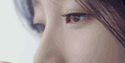 男生割眼皮术后,男性割眼皮后1-7天恢复图