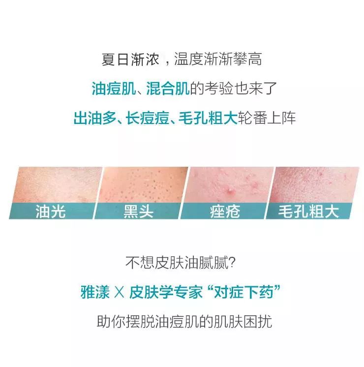 雅漾去油控痘精华测评,雅漾绿小胖控油洁面