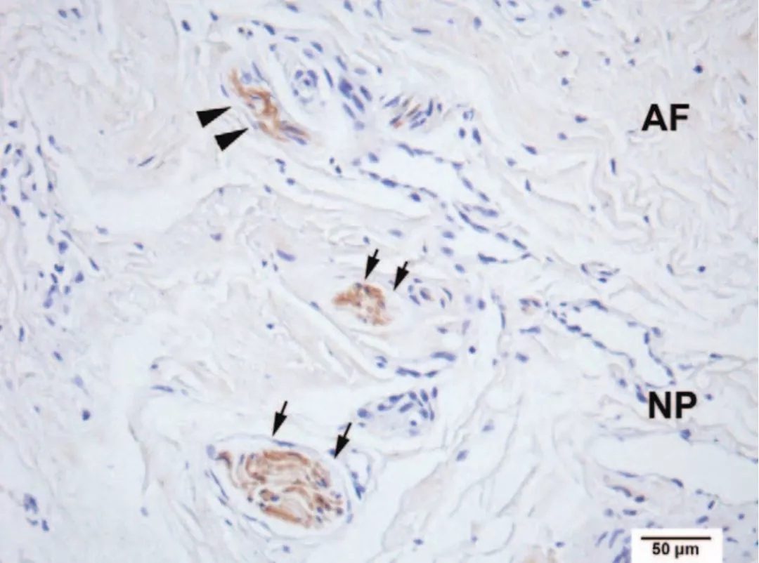 治疗颈椎病引起的眩晕用什么药方,颈椎病眩晕怎么根治
