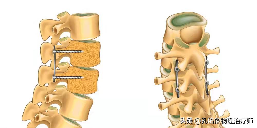 老年人腿脚无力要怎么避免,专治老年人下肢无力的方法