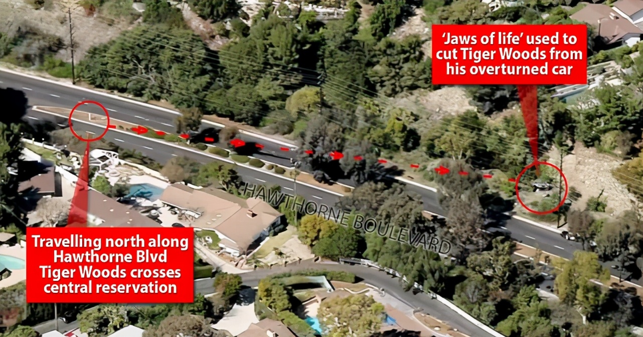 老虎伍兹遇车祸，腿受伤严重需手术，天才高尔夫球手曾因醉驾被捕