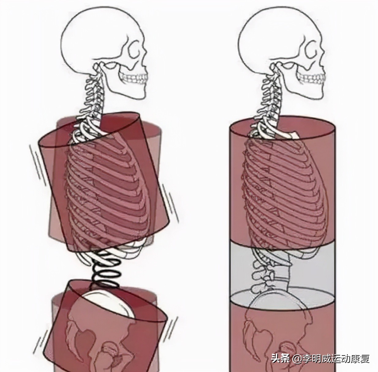 骨盆不正的危害动画视频,骨盆不正危害图片