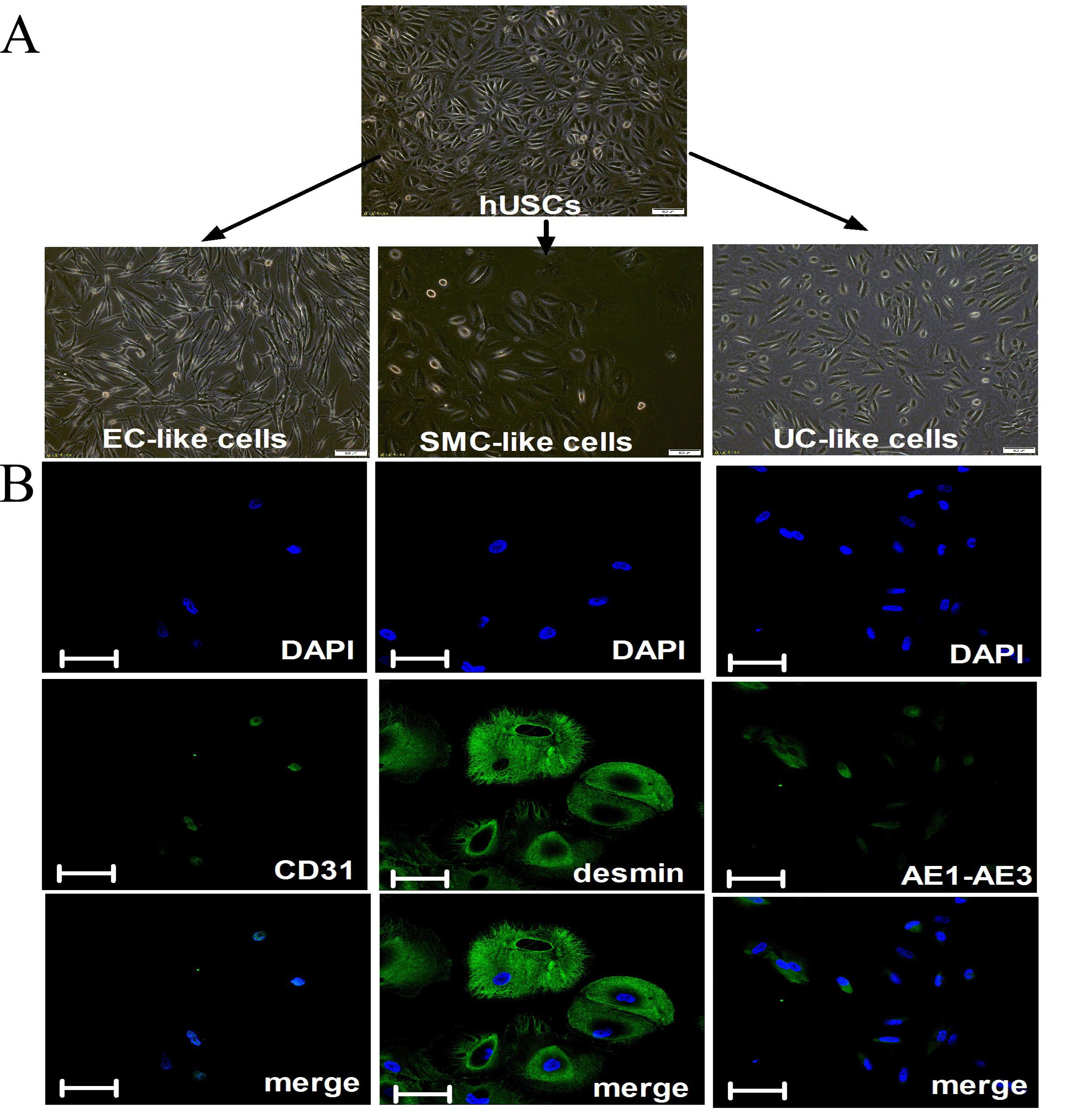 光动力治疗间质性膀胱炎,干细胞治疗间质性肾炎