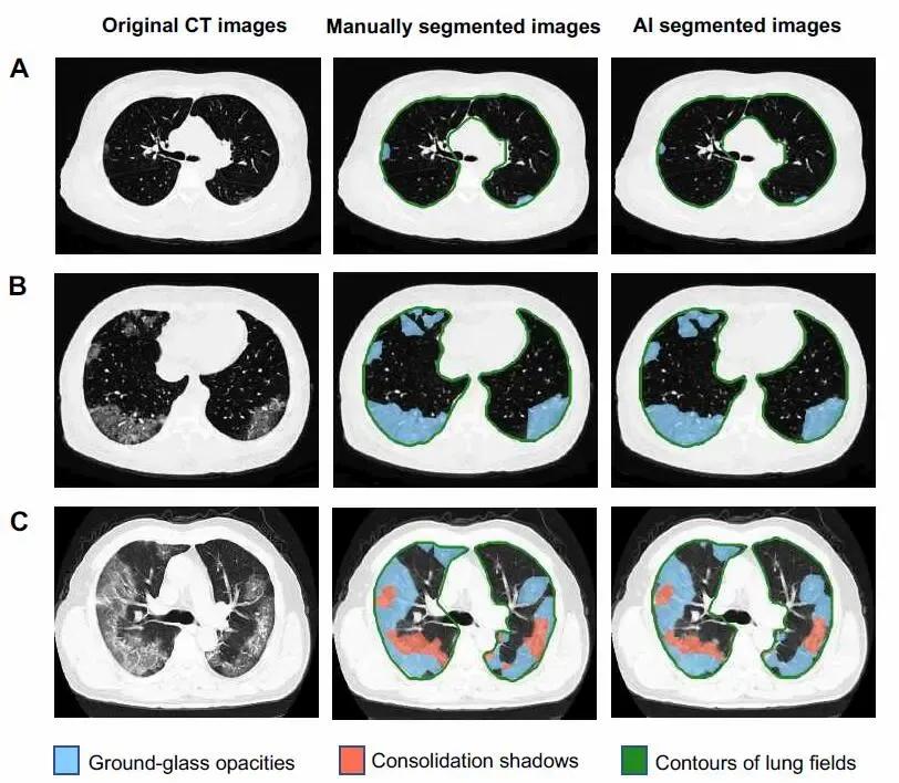 湖北医学院附属医院排名,临床医学大学全球排名
