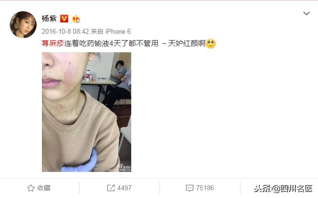 秋冬季补水保湿方法,秋季干性皮肤的补水方法