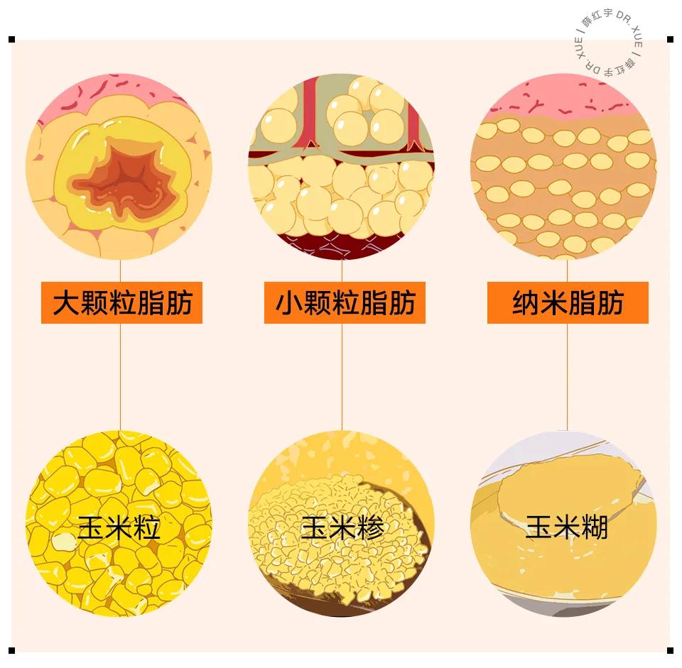 自体脂肪移植后的图片,自体脂肪移植丰胸丰臀