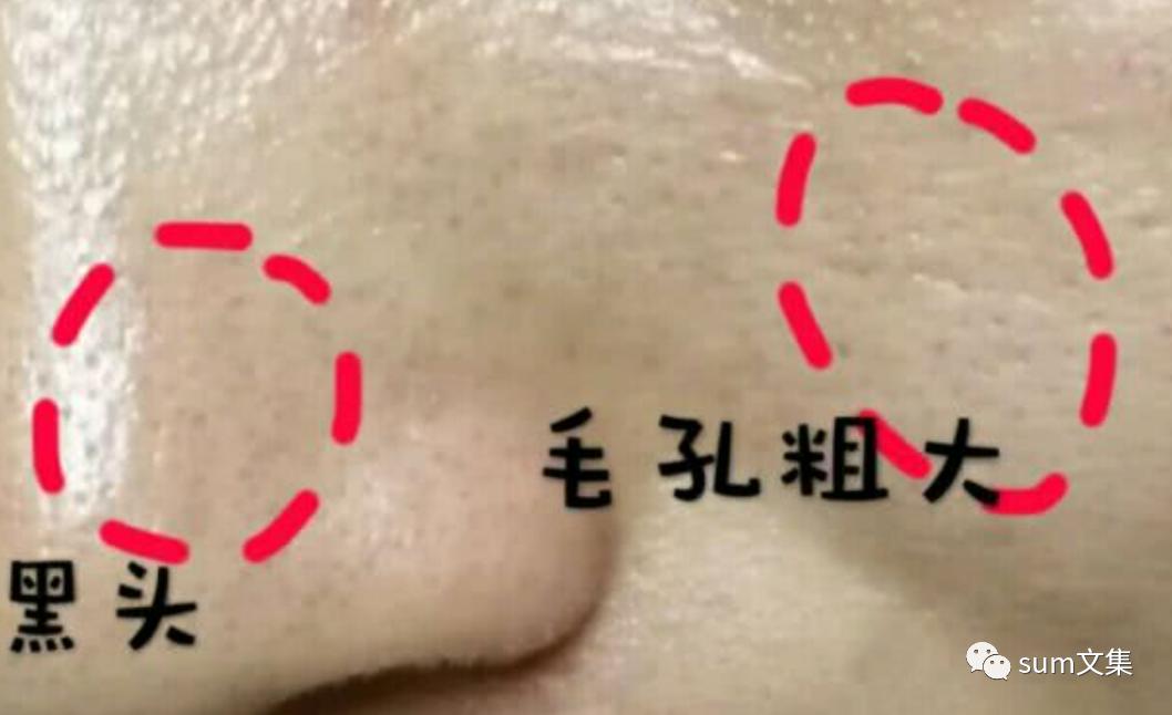 怎么改善毛孔粗大的敏感肌,改善毛孔粗大最有效的办法测评