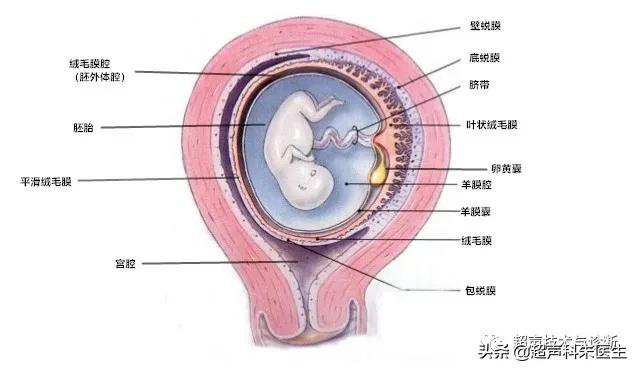 绒毛膜下血肿的超声图像,绒毛膜下血肿一般有啥症状