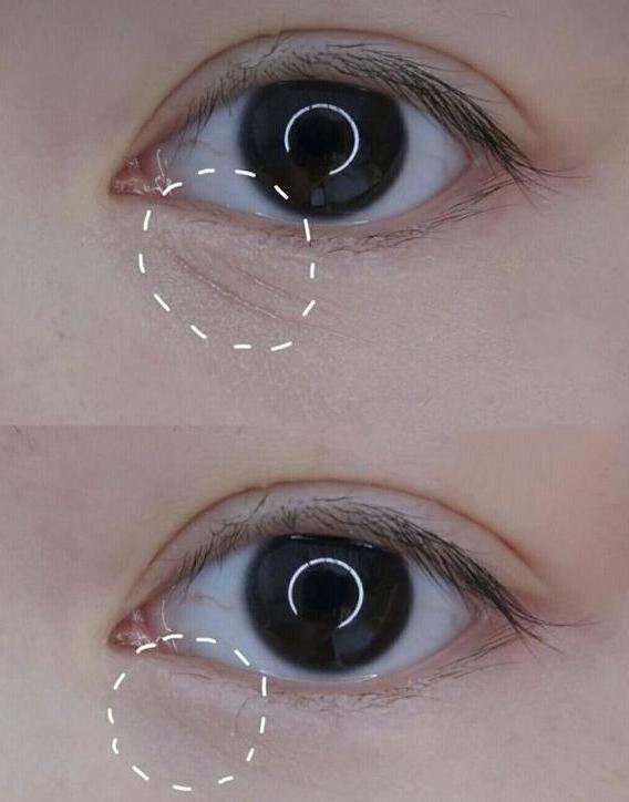 戚薇推荐的40款眼霜,戚薇推荐的15款眼霜