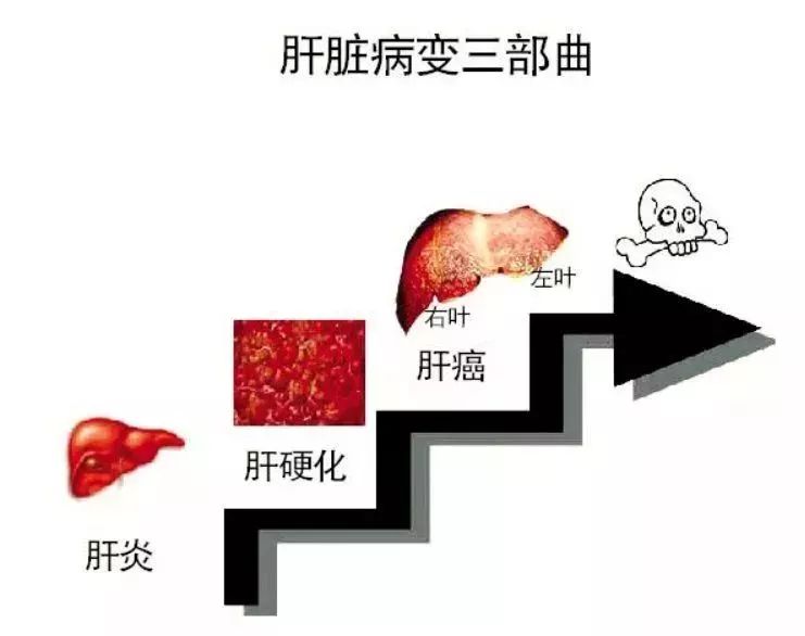 干扰素治疗后复发概率大吗,用了两个疗程干扰素没转阴怎么办