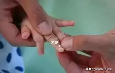 小儿推拿便秘咳嗽,小儿推拿积食通便