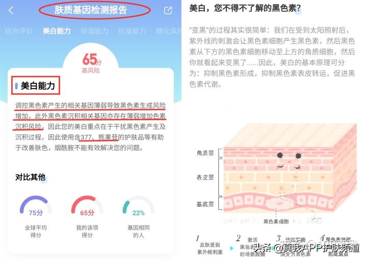 20岁女生可以祛斑吗,20岁的女生脸上有斑以及脸部暗淡