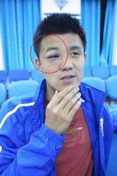 韦世豪足球事件,韦世豪民间事件