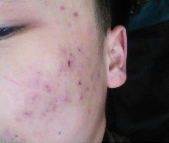 控油保湿护肤品测评男,男士控油控痘护肤品套装推荐