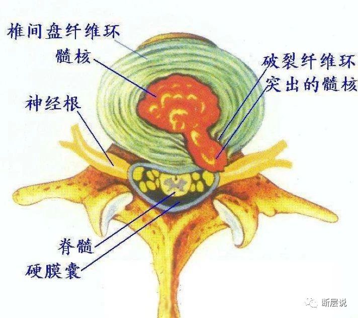 这届年轻人的腰越来越不行了,远离腰痛3大毁腰习惯2步自我康复