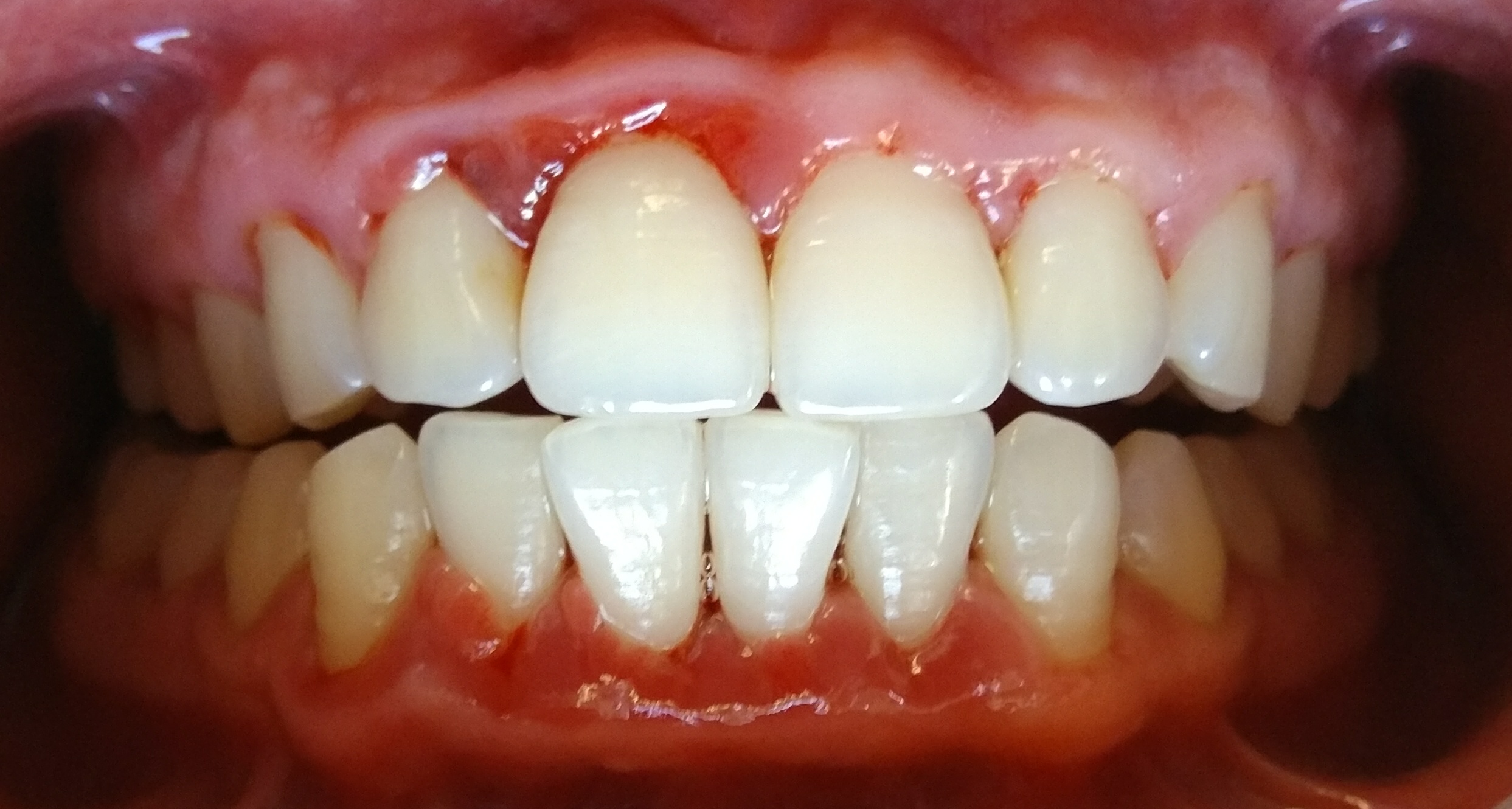 狗狗洗牙的良心忠告,医生忠告千万别洗牙